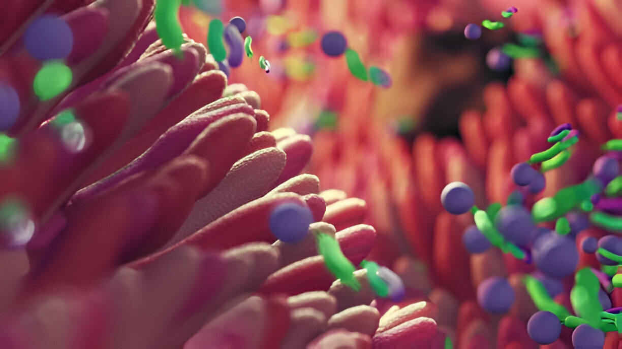 Unveiling the Mystery: Understanding Small Intestinal Bacterial Overgrowth (SIBO)